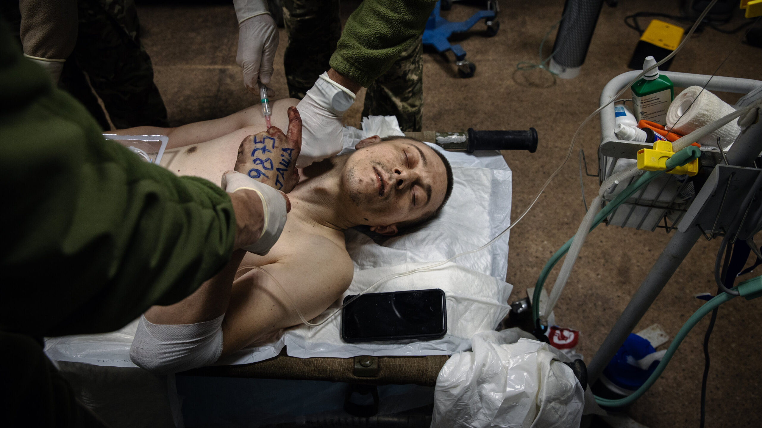 Ukrainian Soldiers Faint from Hunger and Head Injuries on Frontlines in Zaporozhye